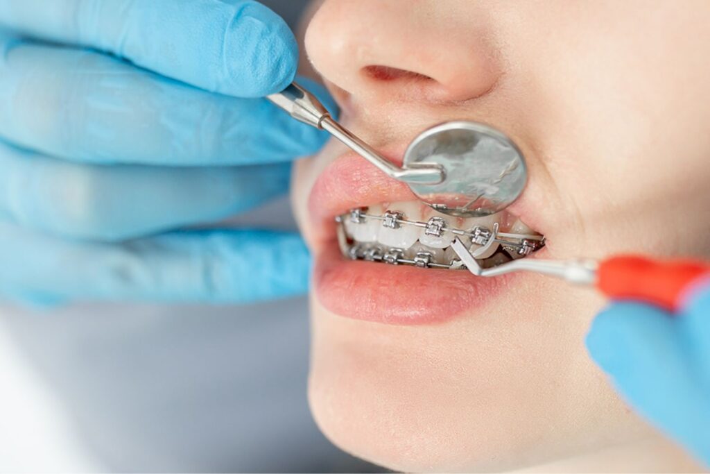 best orthodontist near me in fontana