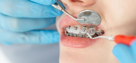 best orthodontist near me in fontana